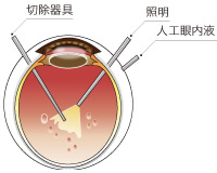 手術図